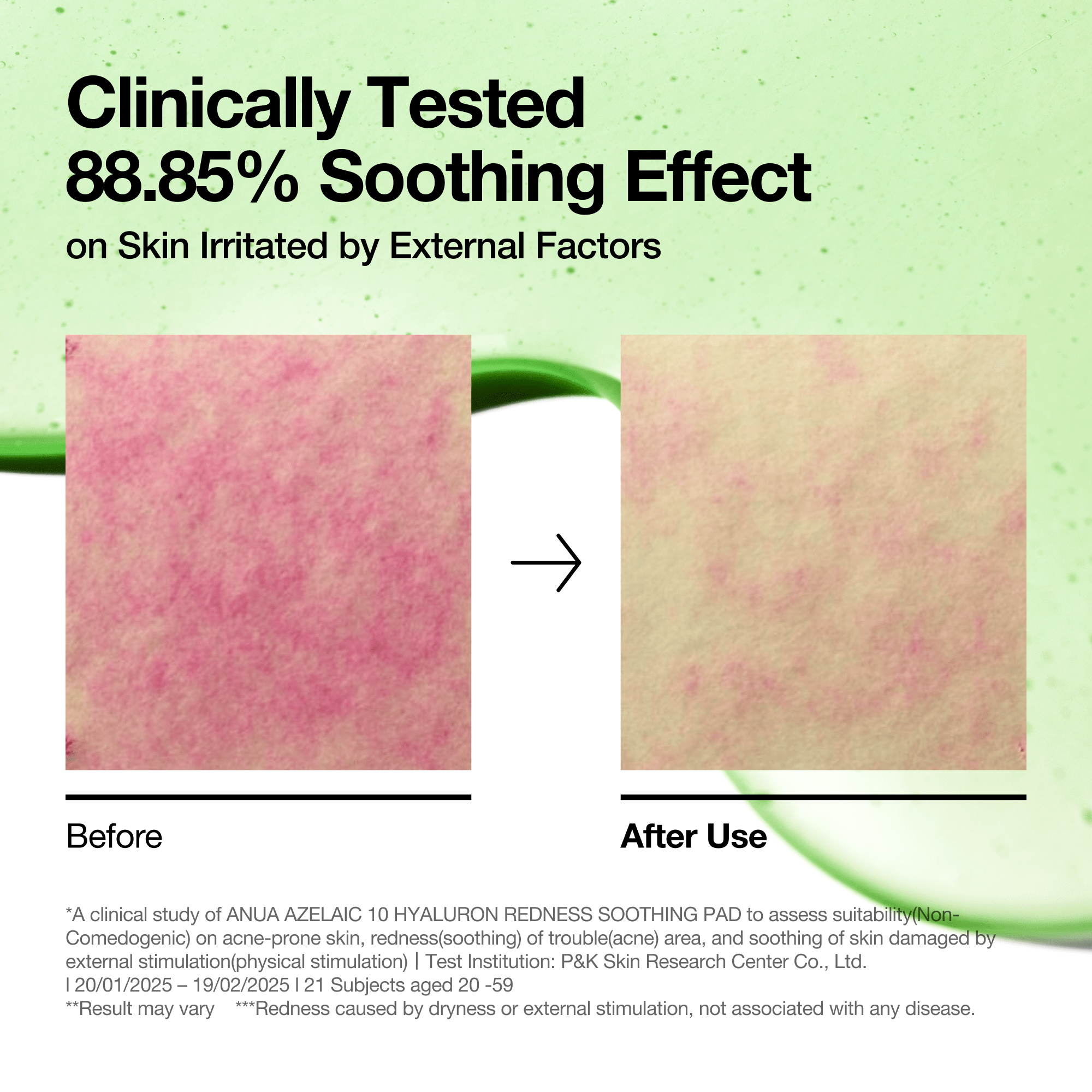 Azelaic 10 Hyaluron Redness Calming Pad