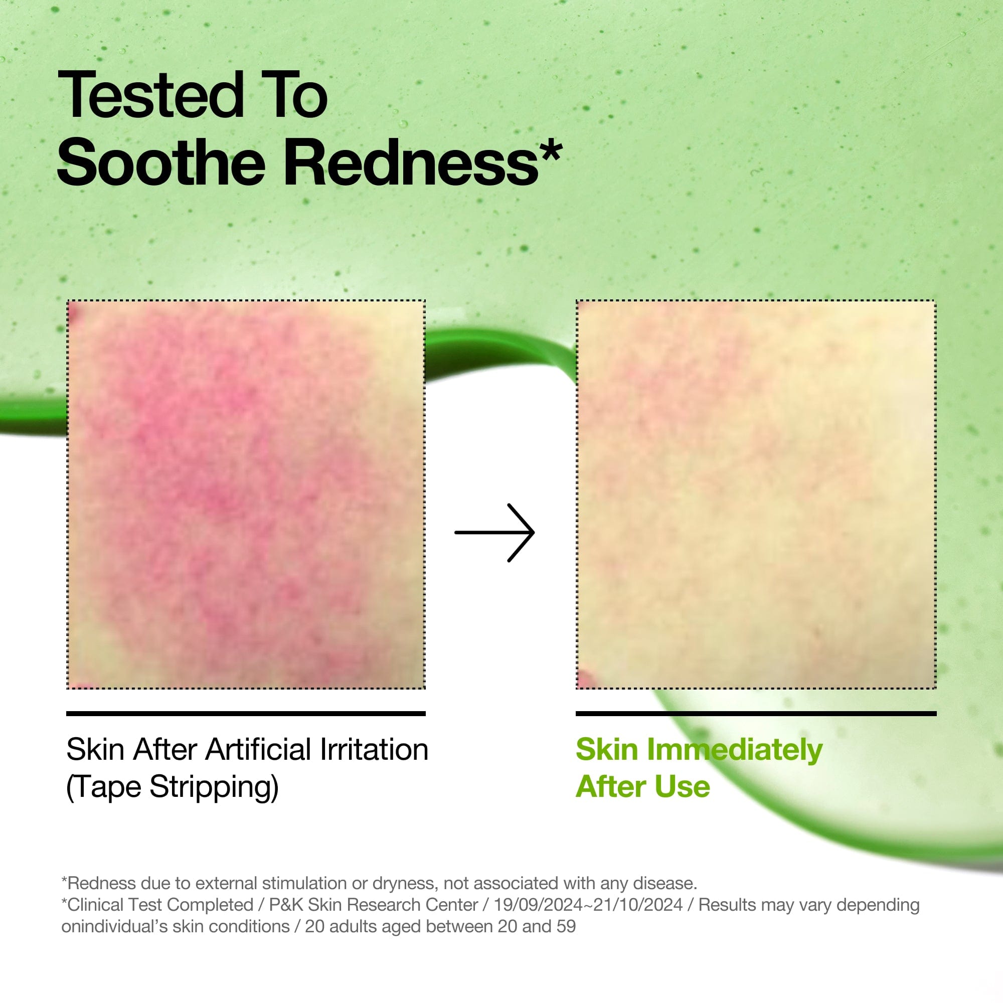 Azelaic Acid 10 Hyaluron Redness Calming Serum